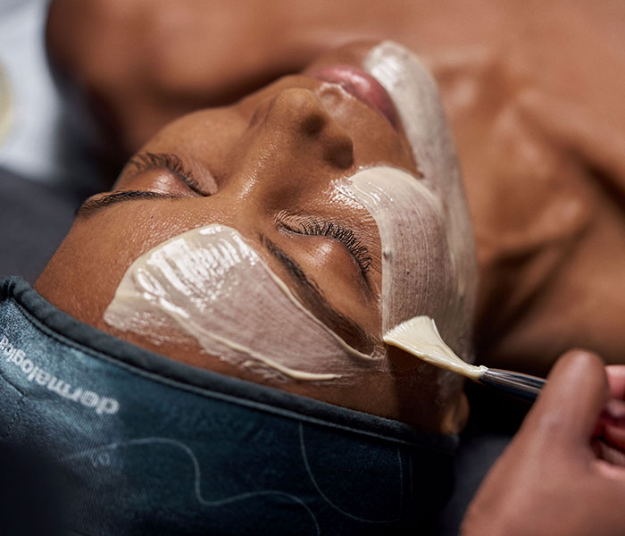 Pro Calm 60 skin rejuvenation treatment